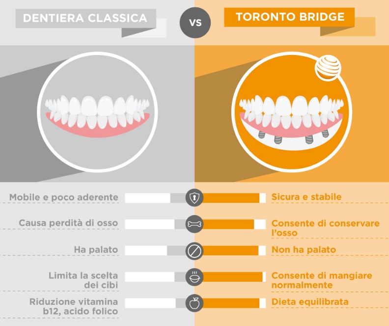Toronto Bridge VS Dentiera - Infografica