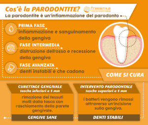 Parodontite alle Gengive